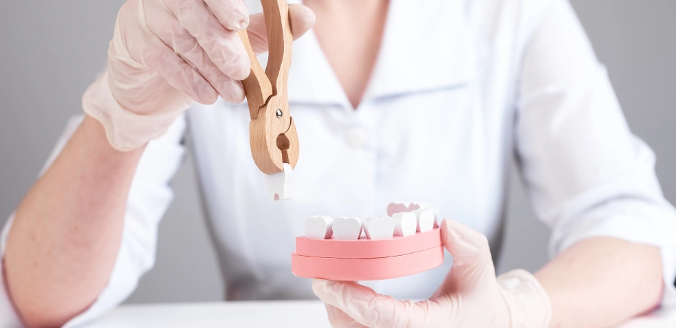 extraccion diente intervencion