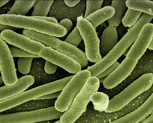 Vista a microscopio de la bacteria que causa la listeria