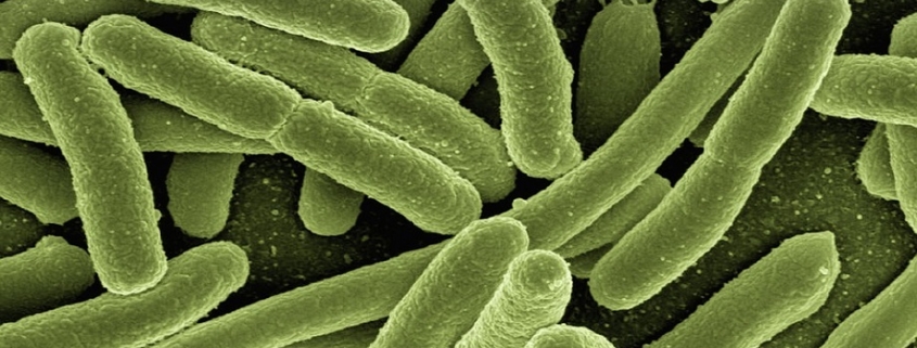 Vista a microscopio de la bacteria que causa la listeria