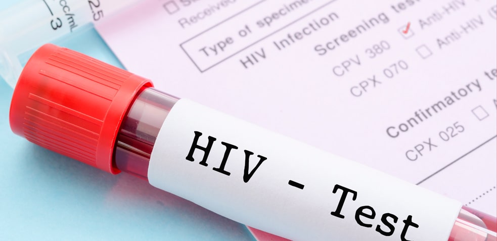 Test de HIV sobre unos documentos médicos