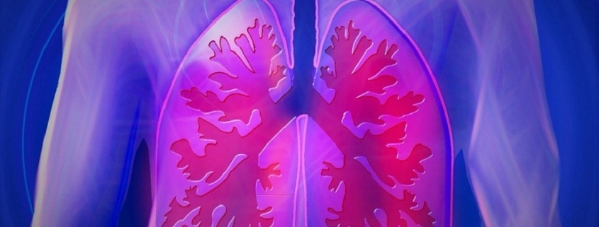 pulmones, neumonía