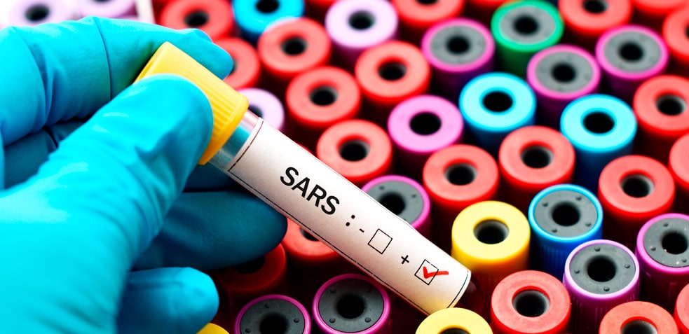 bote de extracción para el SARS, un virus de la familia de los coronavirus