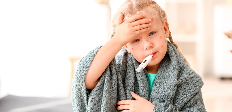 niña rubia pequeña con varicela que sostiene un termómetro en la boca