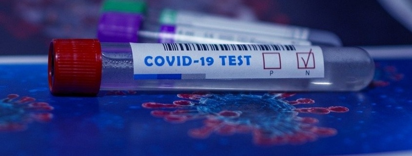 Prueba PCR ,se emplea como un test de diagnóstico, que determina si en ese momento tenemos el virus