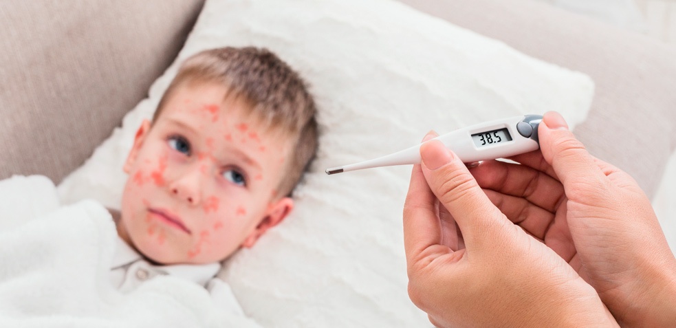 Termómetro da un valor de 38,5 grados de temperatura corporal en un niño con sarampión 