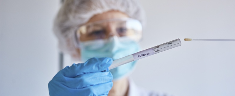 Tubo de ensayo con el que se hacen los test de antígenos y las pruebas PCR