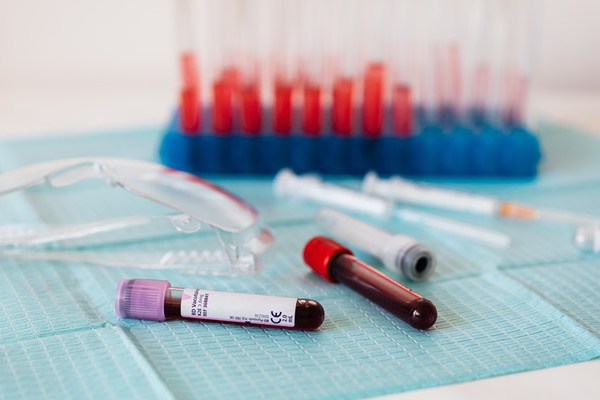 tubos de extracción de sangre junto con otros materiales de laboratorio