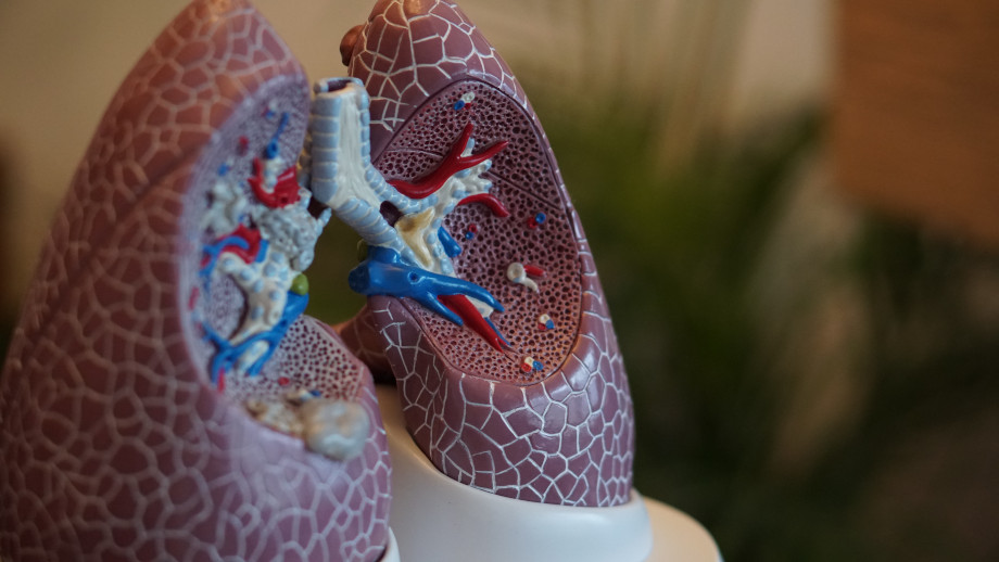 sintomas de la bronquitis crónica afecta aire que llega a los pulmones
