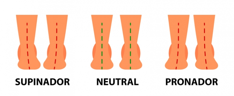 ¿eres Pronador O Supinador Tipos De Pisadaemk 8252