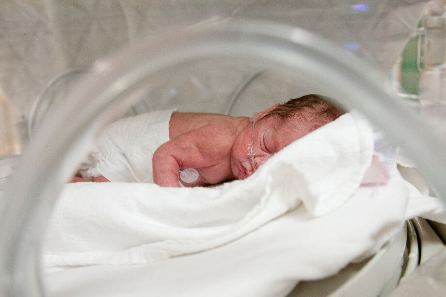 bebé en incubadora por ser uno de los bebés prematuros
