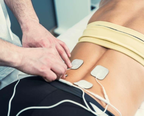 tratamiento de fisioterapia con electrodos en la espalda