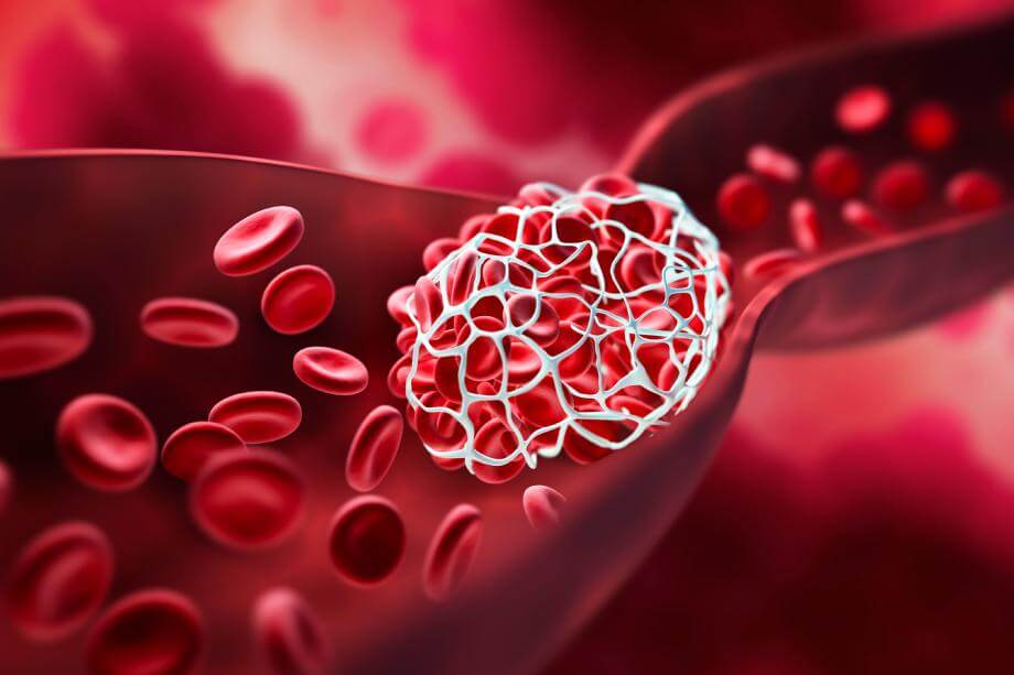 los medicamentos anticoagulantes evitan coágulos en la sangre