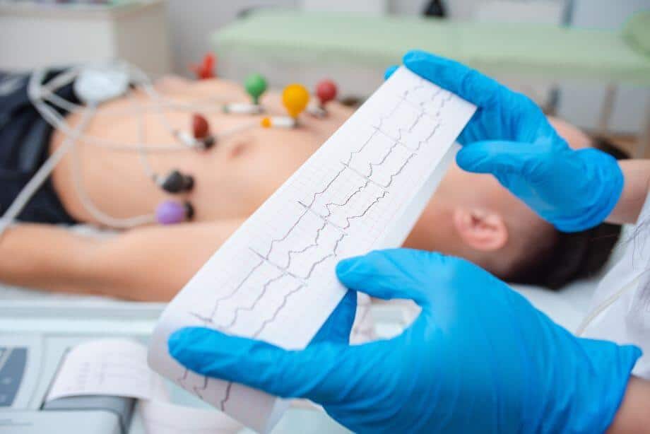 Electrocardiograma para detectar bradicardia sinusal