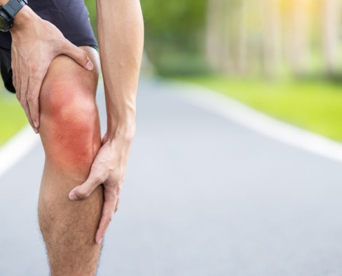 la condromalacia es una de las lesiones de rodilla más habituales