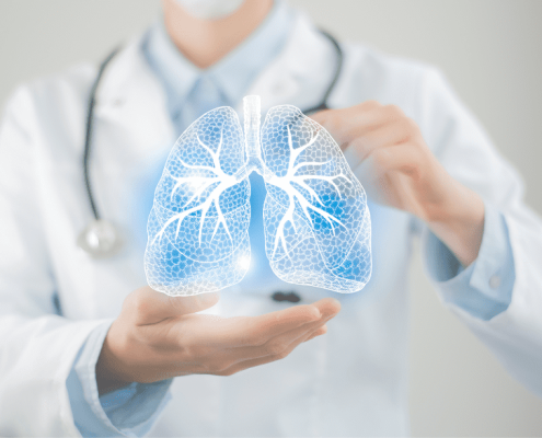 médico irreconocible con representación pulmones en las manos sarcoidosis