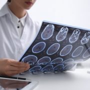 doctor revisando placa tumor cerebral