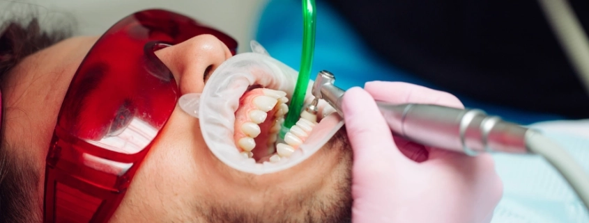 limpieza bucal dentista