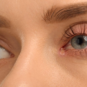 sintomas-insolacion-como-tratarla