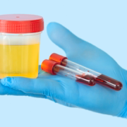 sintomas-insolacion-como-tratarla