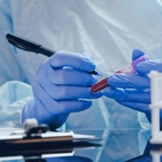 sintomas-insolacion-como-tratarla