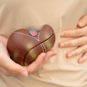 sintomas-insolacion-como-tratarla