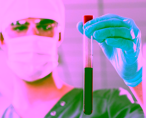 Profesional sanitario sosteniendo una muestra de sangre para análisis de homocisteína